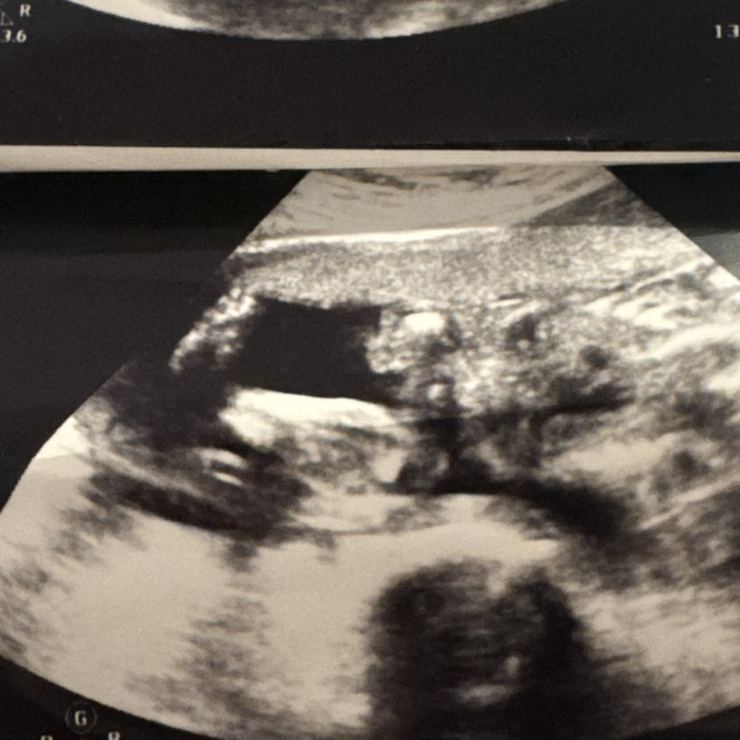 Photo shared by Breeann for their Babylist baby registry.