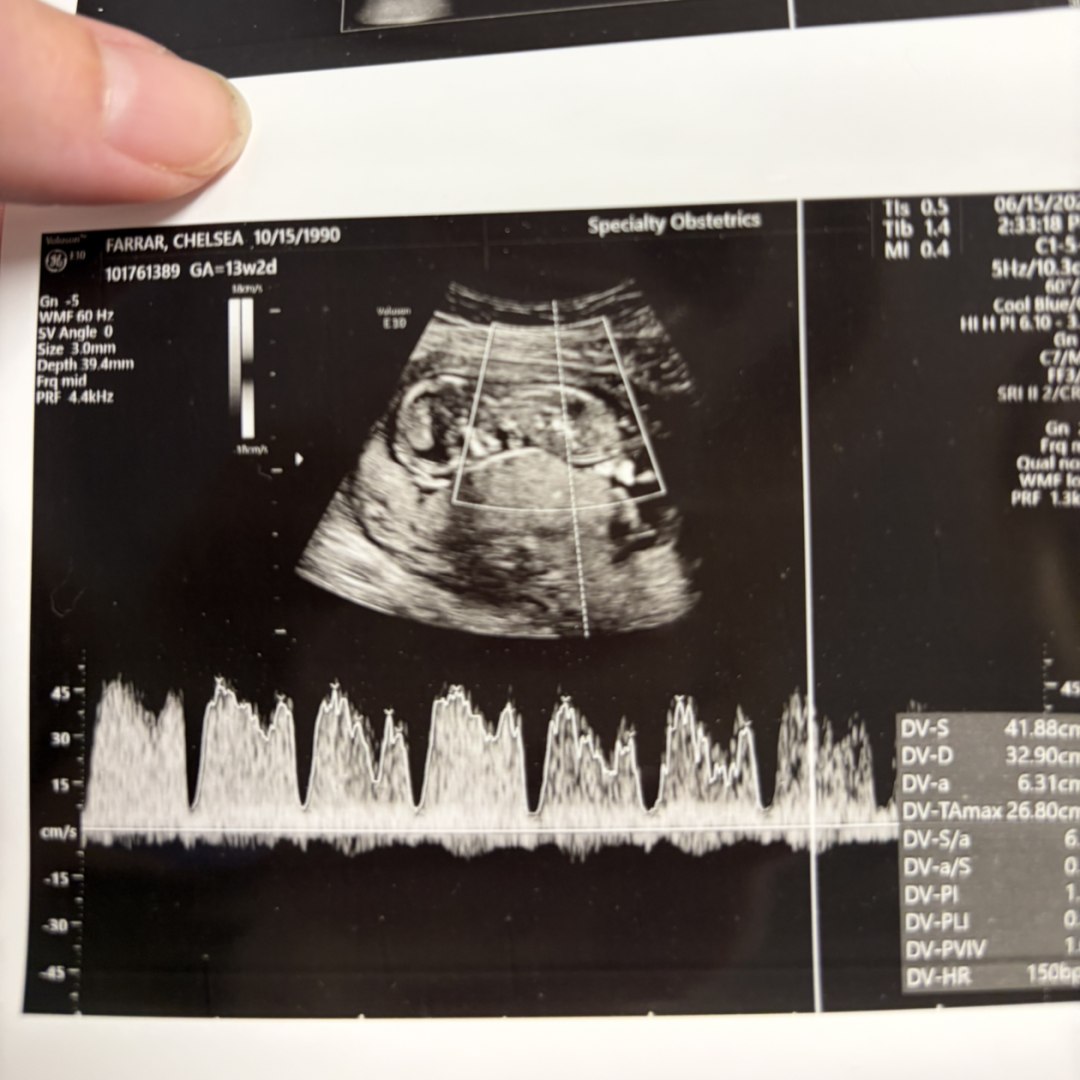 Photo shared by Chelsea for their Babylist baby registry.