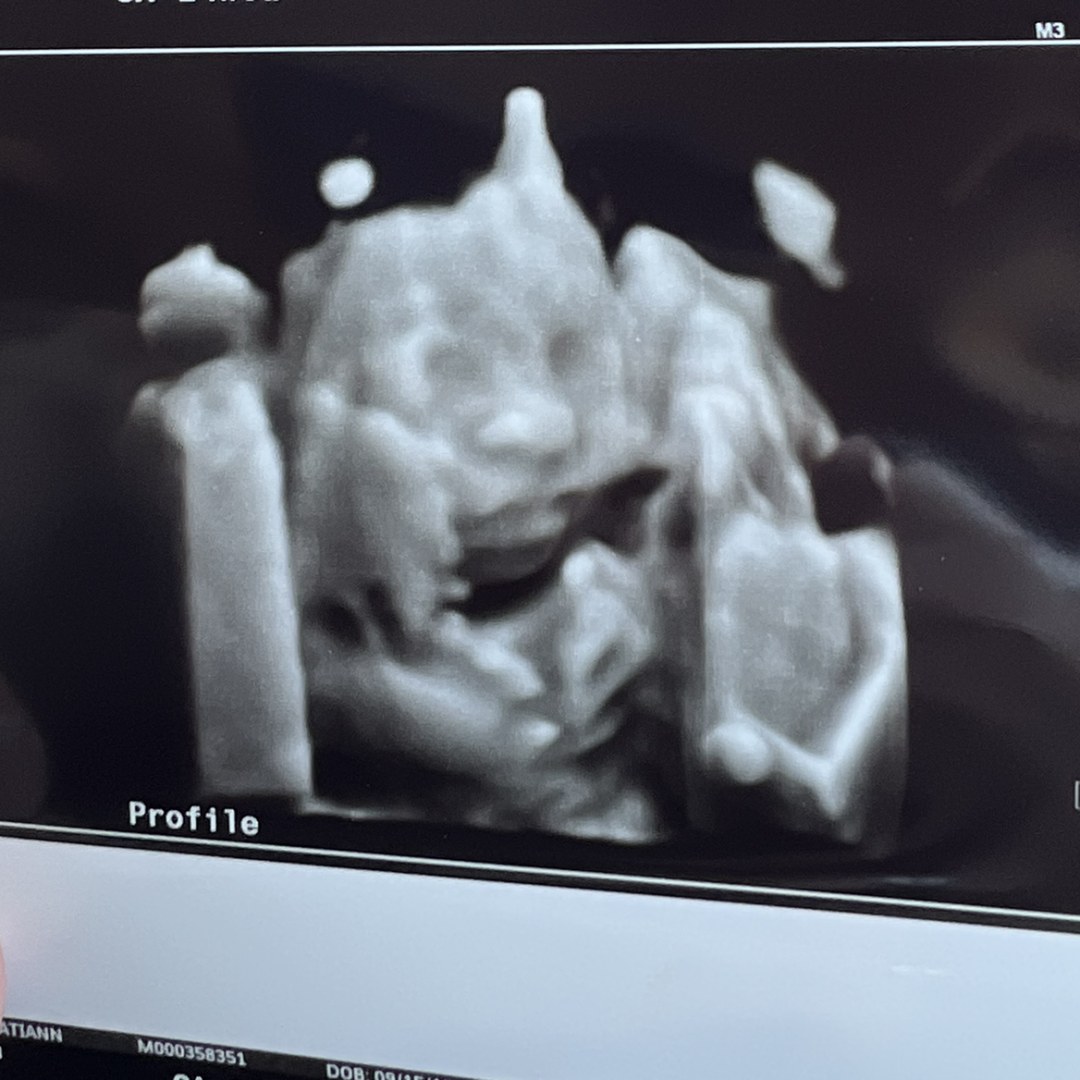 Photo shared by Kati for their Babylist baby registry.