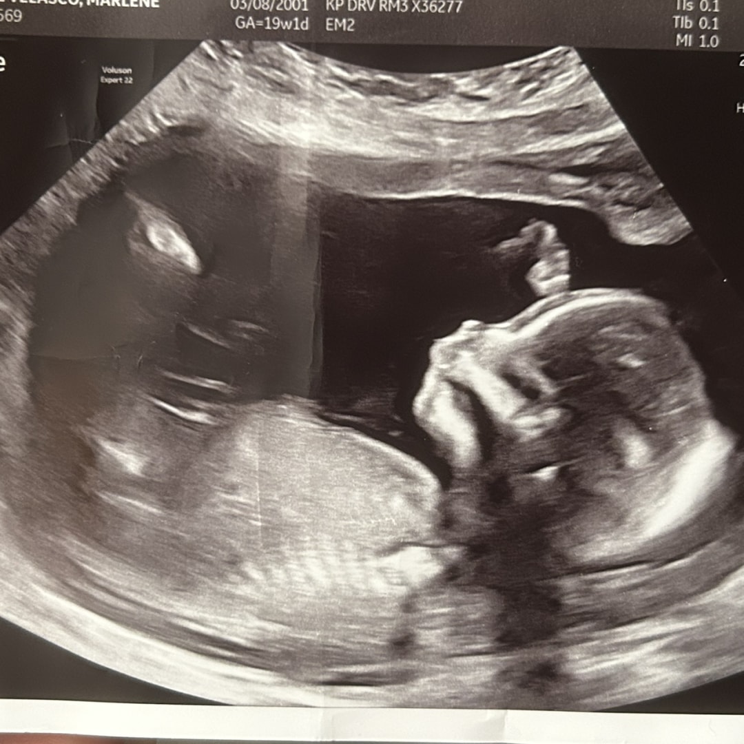 Photo shared by Marlene for their Babylist baby registry.