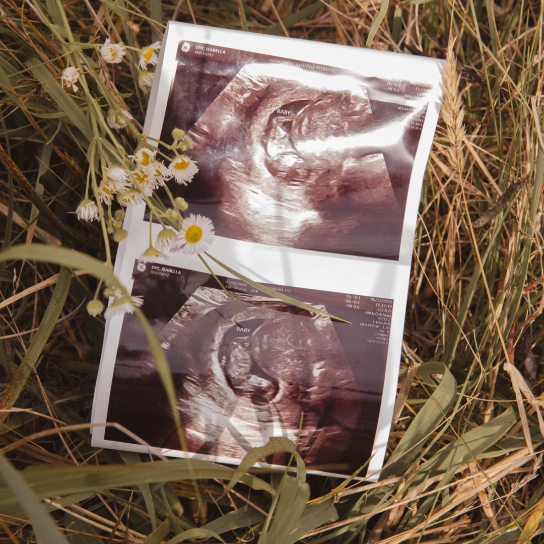 Photo shared by Isabella for their Babylist baby registry.