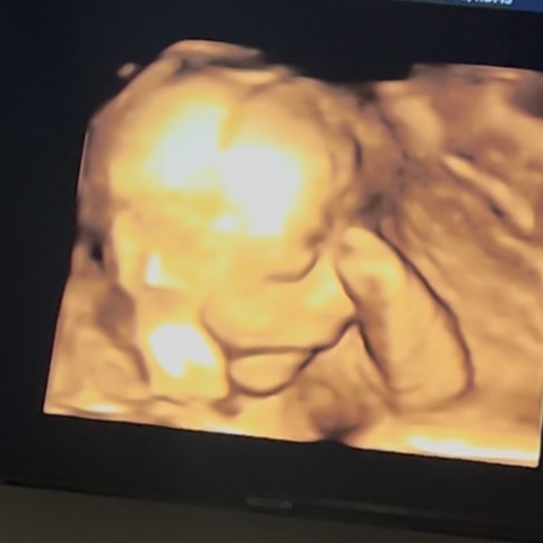 Photo shared by Gabi for their Babylist baby registry.