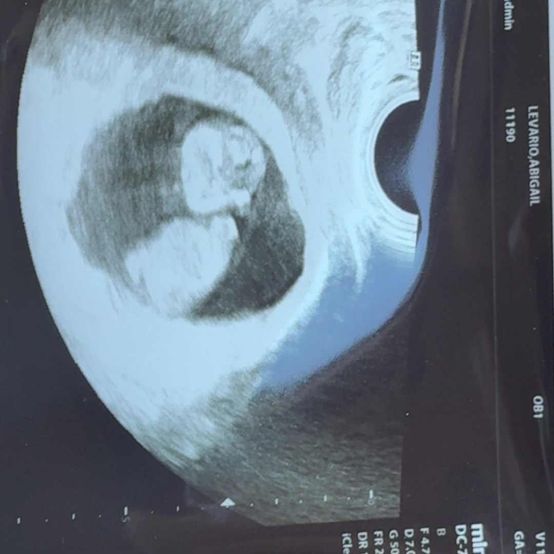 Photo shared by Abigail for their Babylist baby registry.