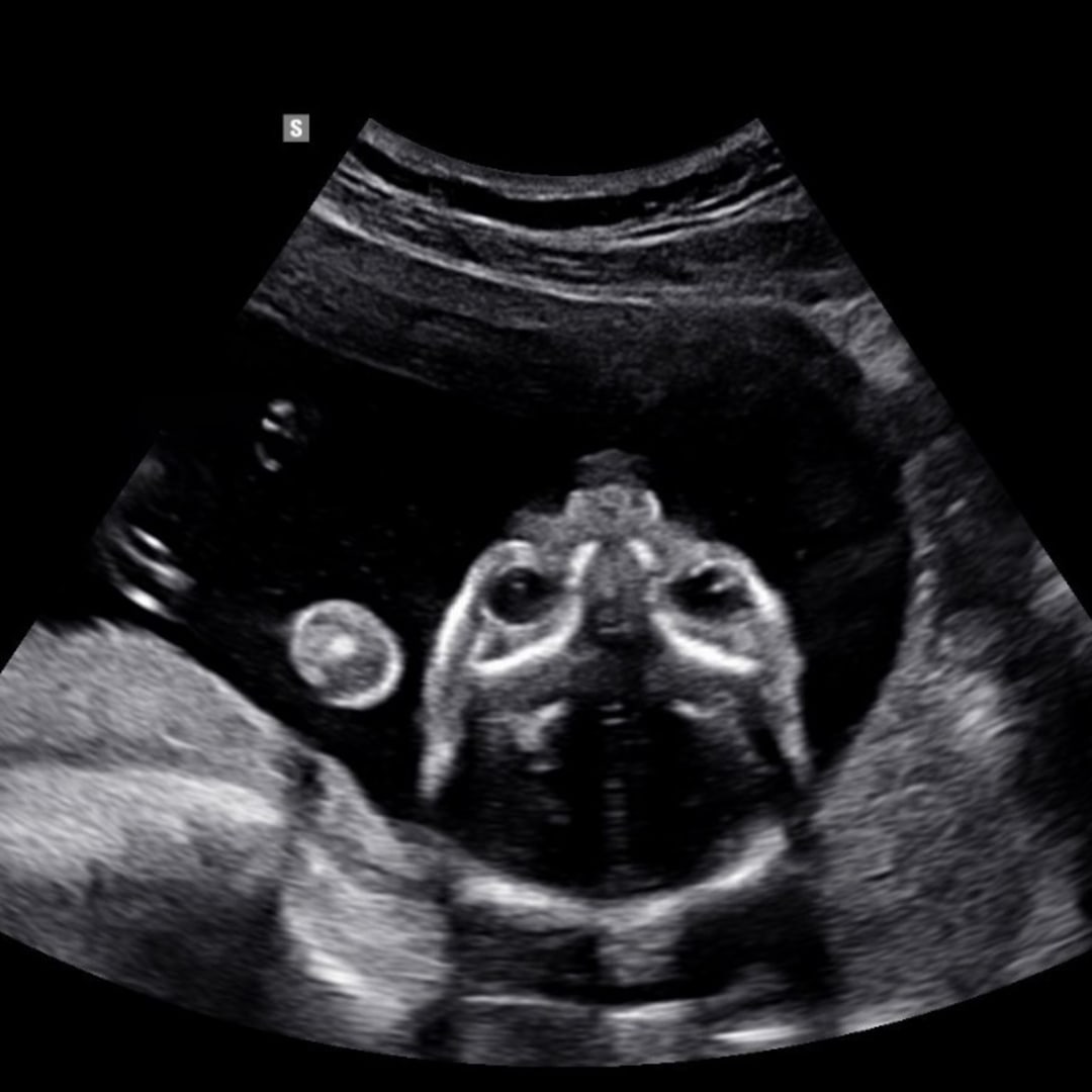 Photo shared by Haven for their Babylist baby registry.