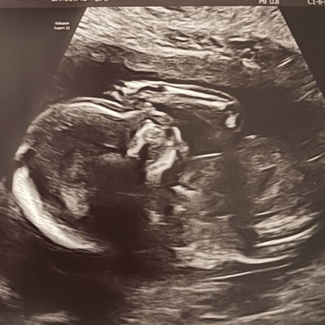 Photo shared by Alina for their Babylist baby registry.