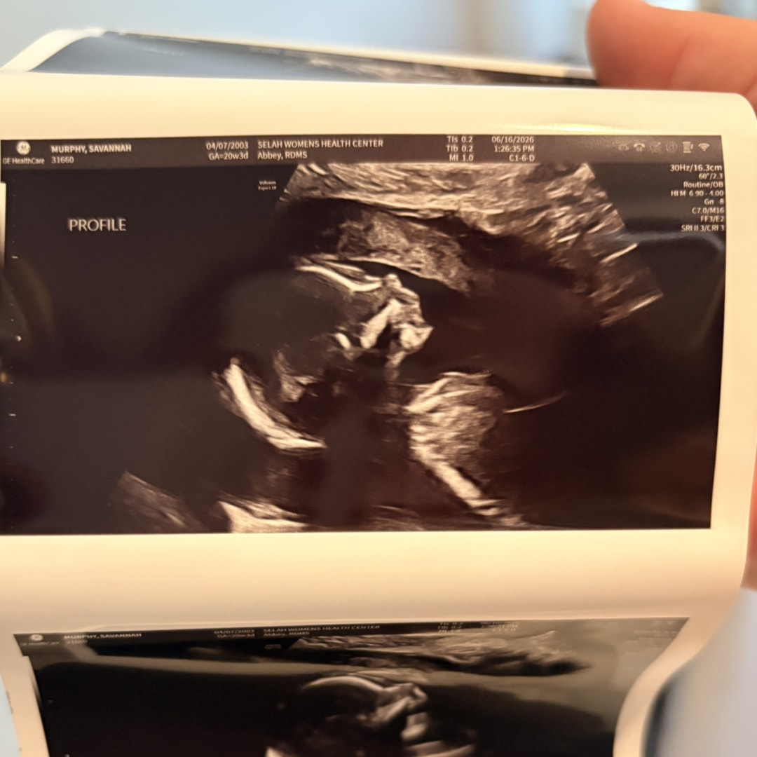 Photo shared by Savannah for their Babylist baby registry.