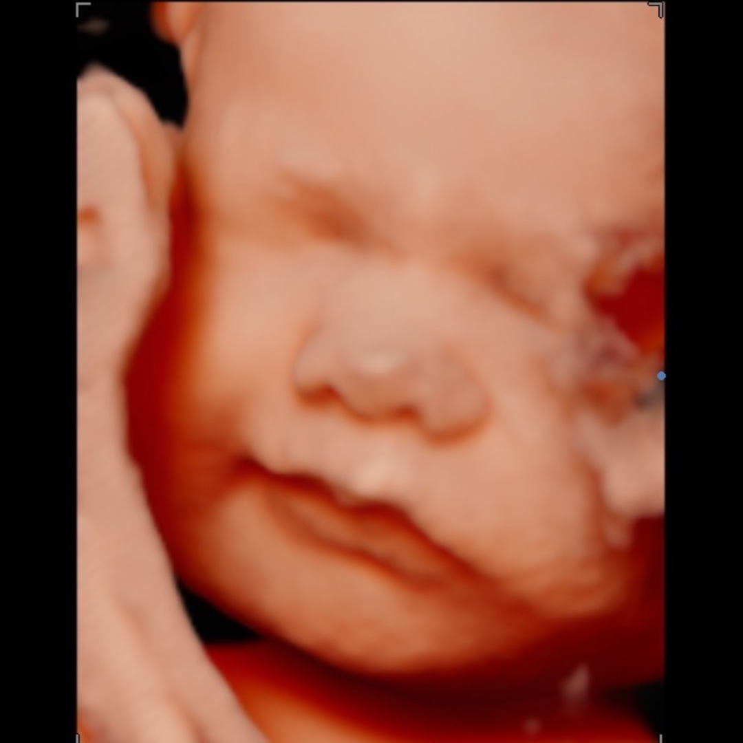 Photo shared by Adrienna for their Babylist baby registry.