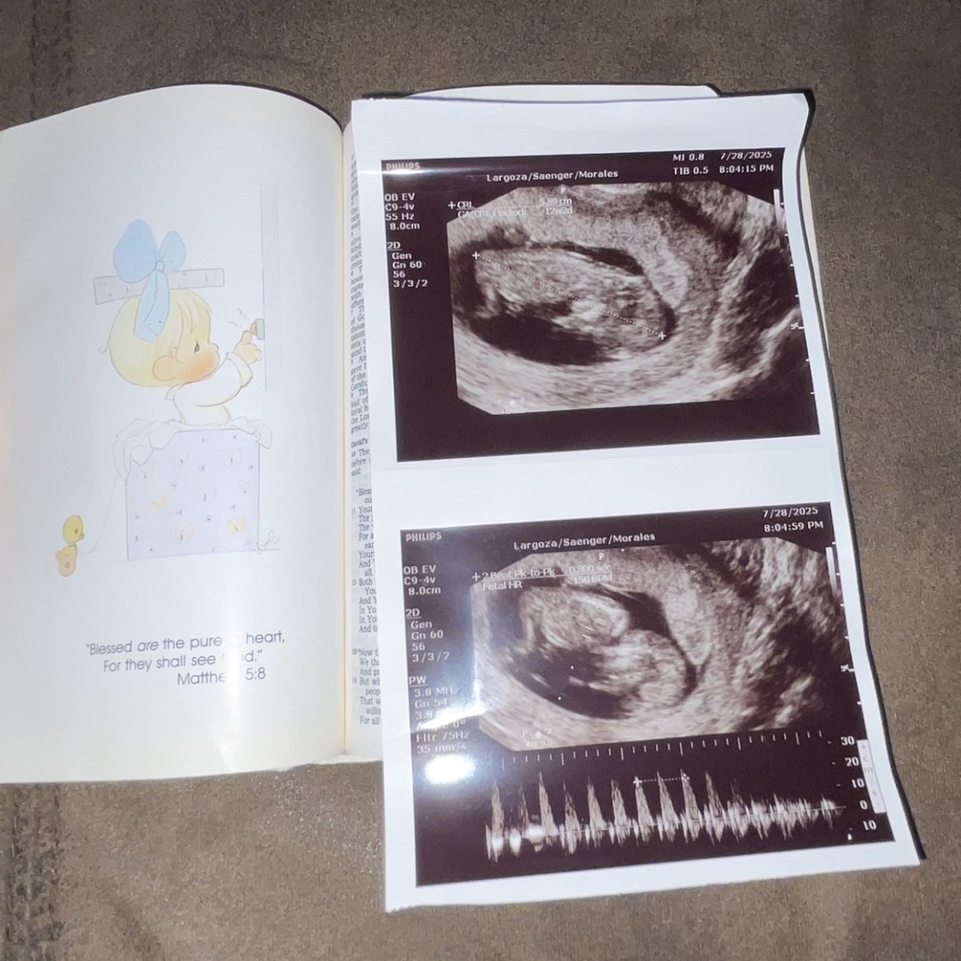 Photo shared by Patricia for their Babylist baby registry.