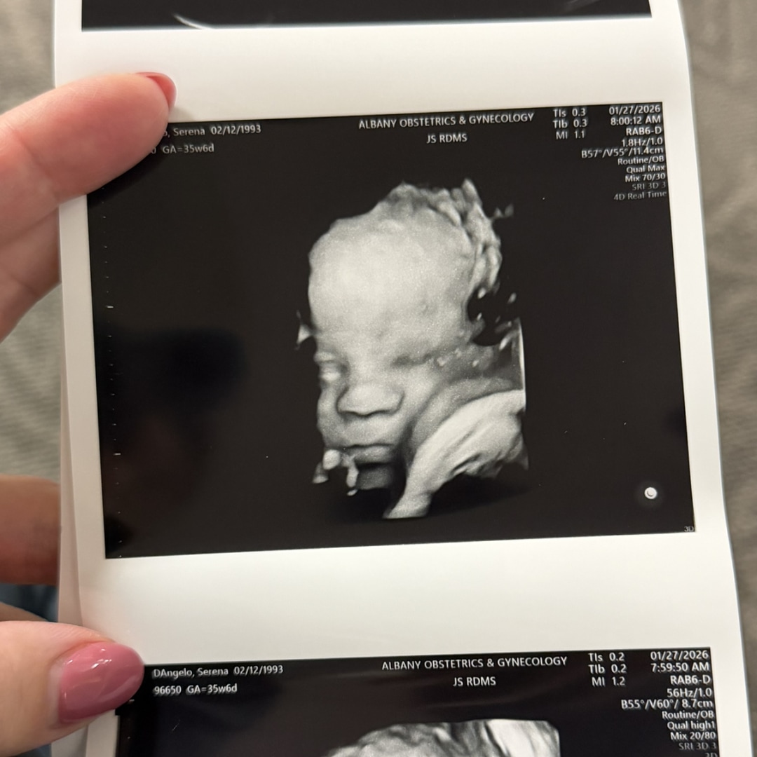 Photo shared by Serena for their Babylist baby registry.