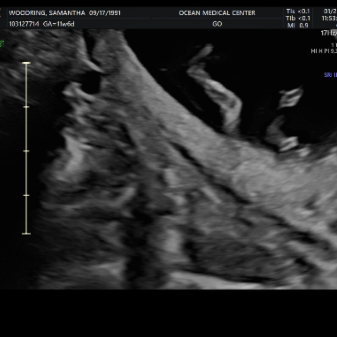 Photo shared by Samantha for their Babylist baby registry.