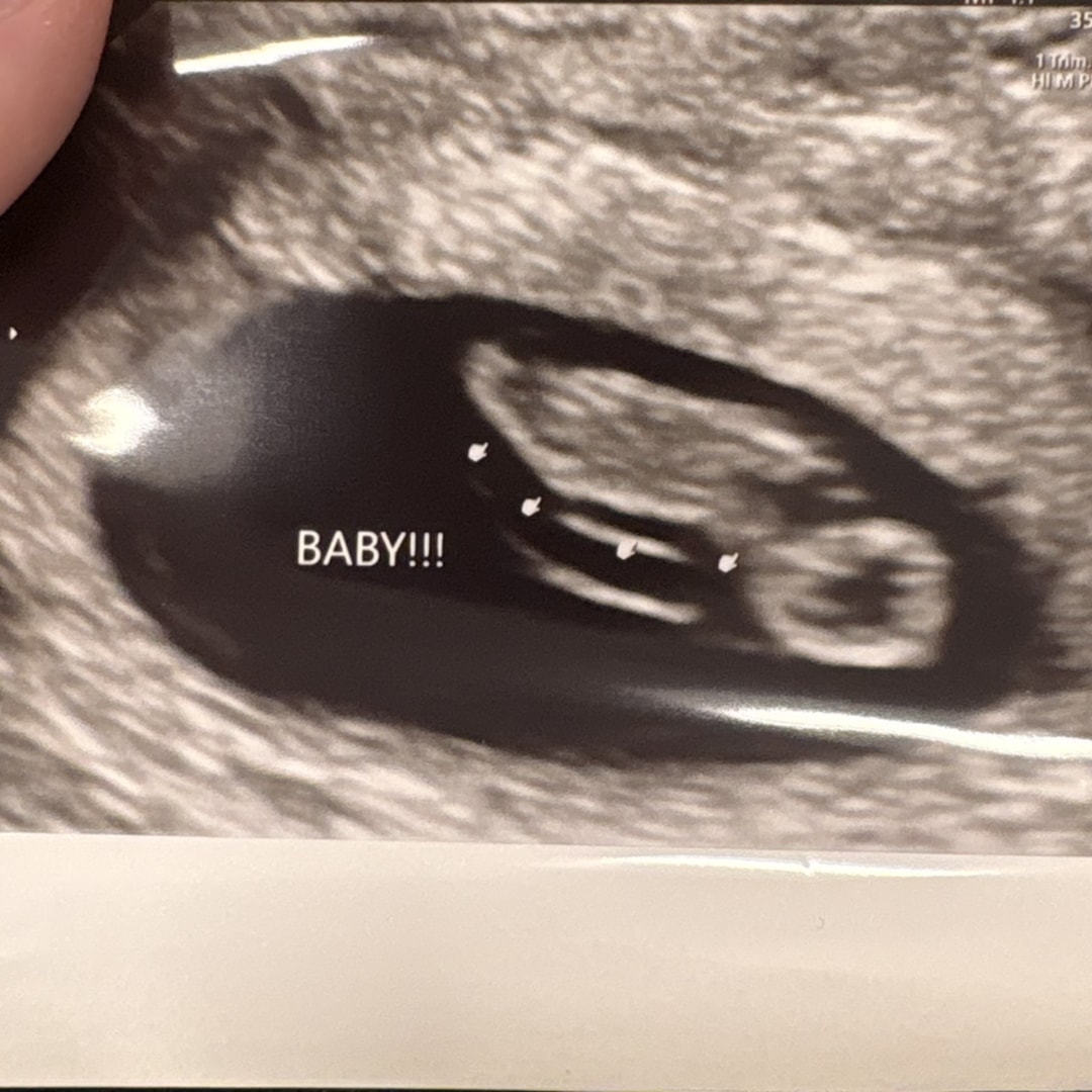 Photo shared by Savanah for their Babylist baby registry.