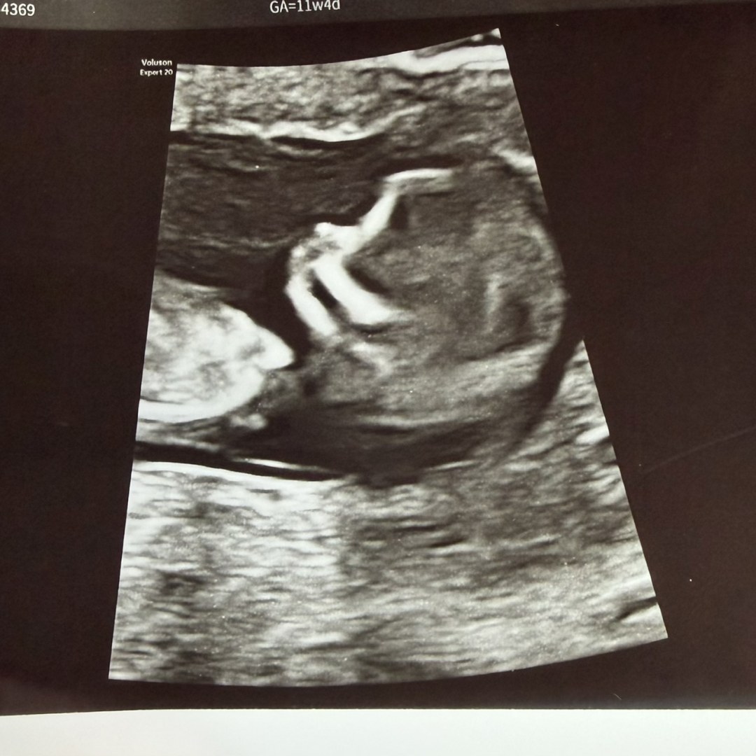Photo shared by Jada for their Babylist baby registry.