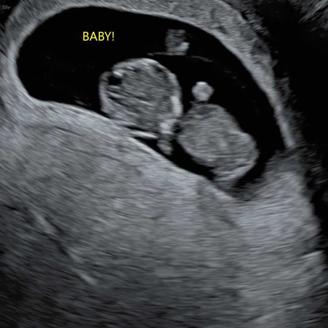 Photo shared by Alexis for their Babylist baby registry.