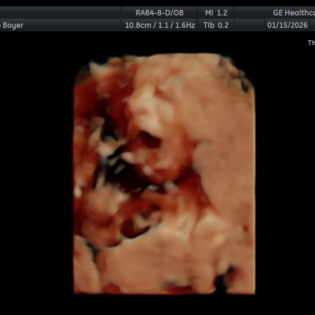 Photo shared by Chloe for their Babylist baby registry.