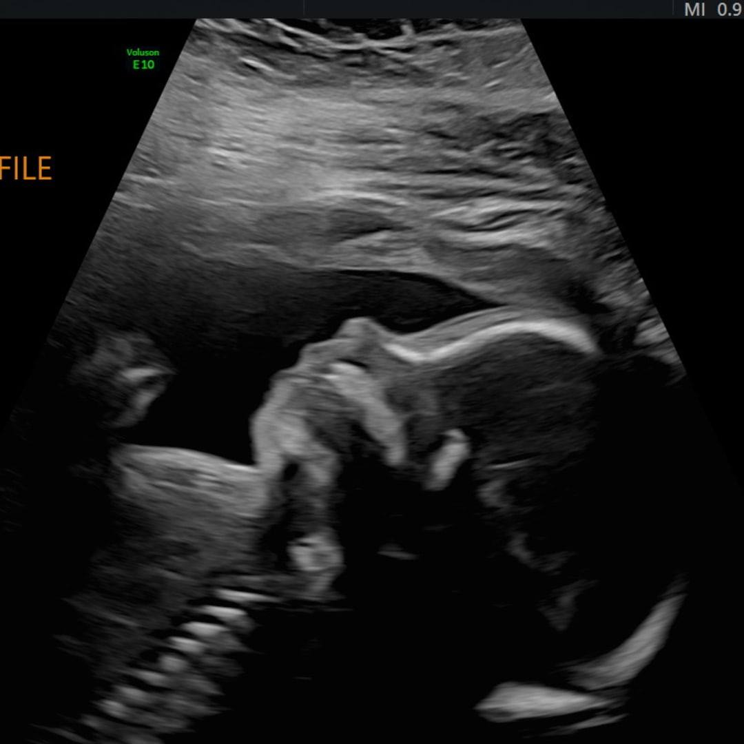 Photo shared by Sam for their Babylist baby registry.