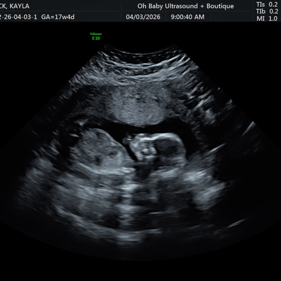 Photo shared by Kayla for their Babylist baby registry.