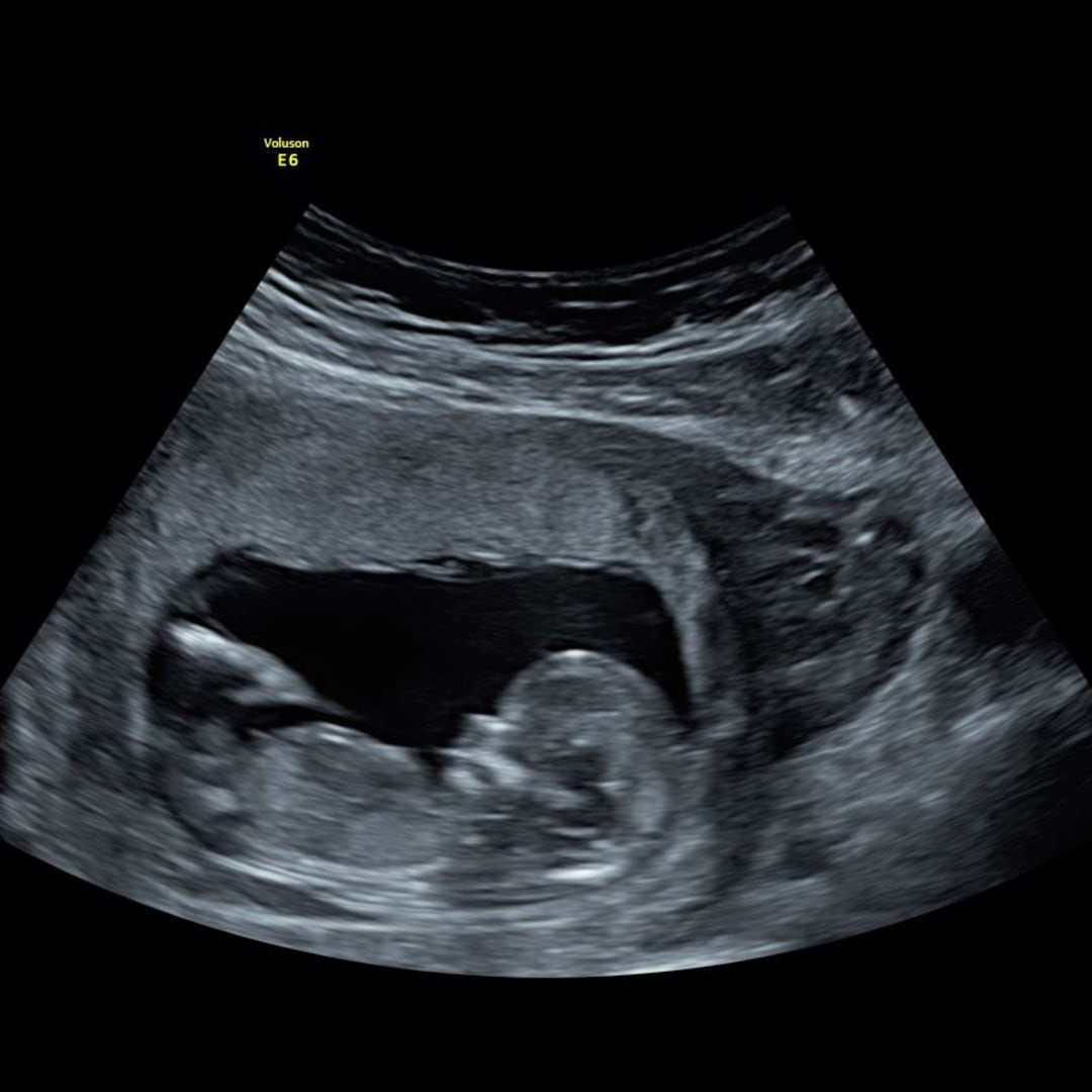 Photo shared by Hannah for their Babylist baby registry.