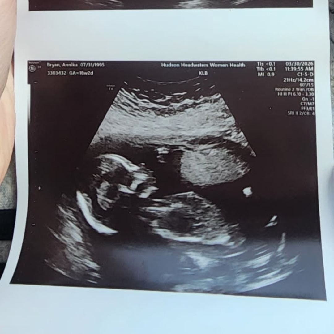 Photo shared by Annika for their Babylist baby registry.
