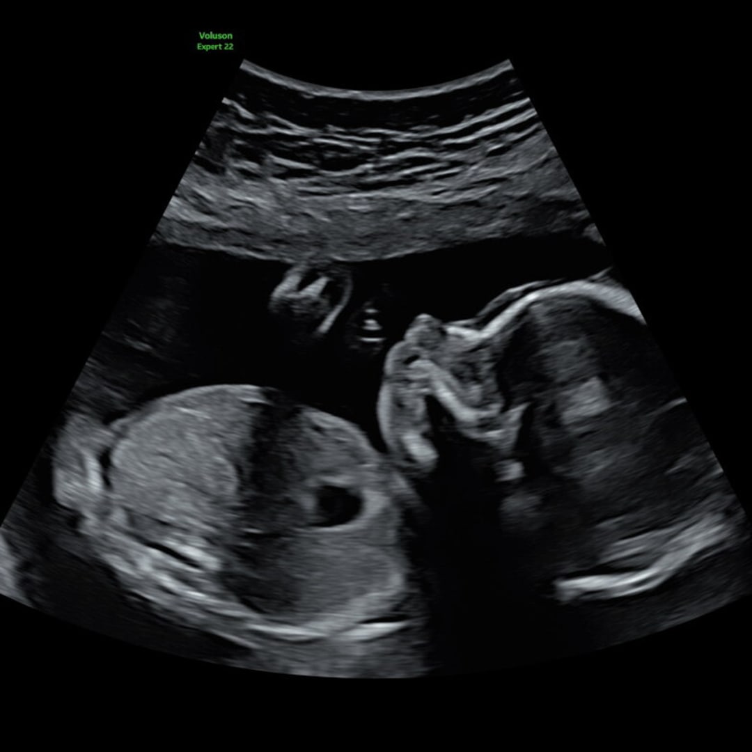 Photo shared by Ana for their Babylist baby registry.