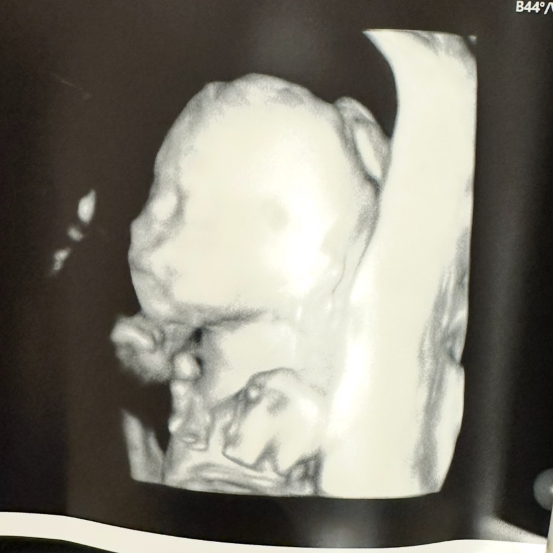 Photo shared by Gabrielle for their Babylist baby registry.