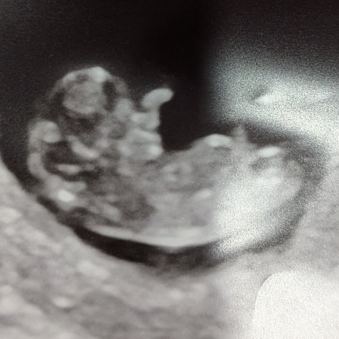 Photo shared by Andi for their Babylist baby registry.