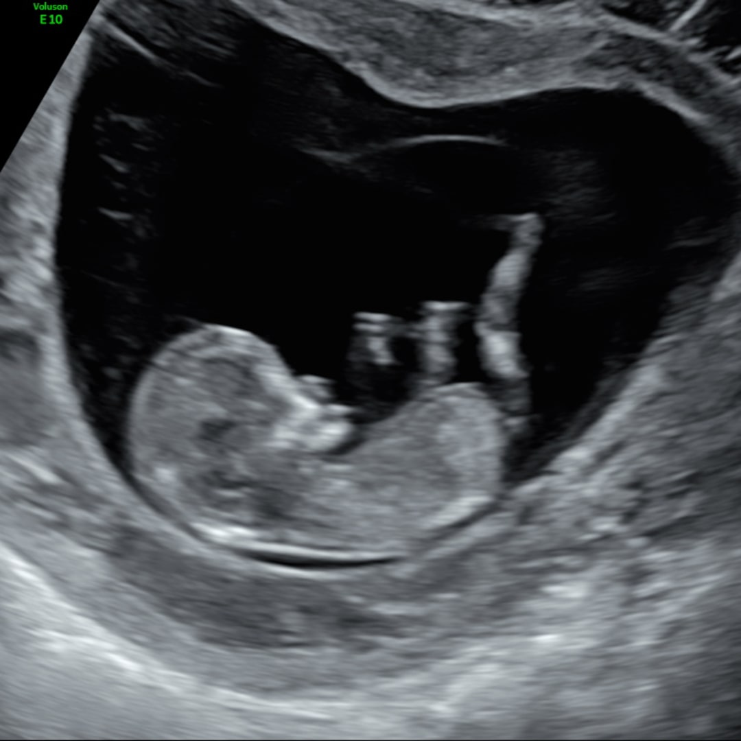 Photo shared by Hope for their Babylist baby registry.
