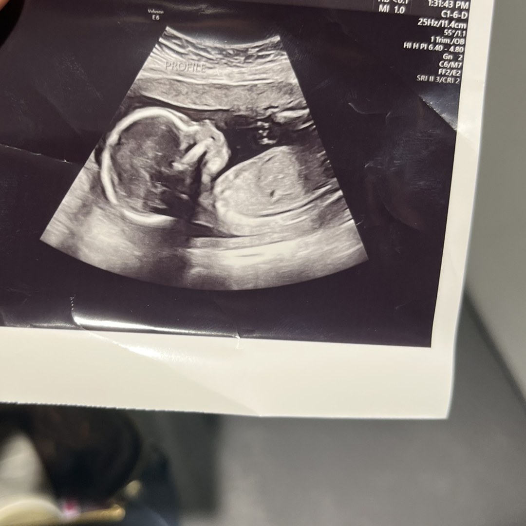 Photo shared by Autumn for their Babylist baby registry.