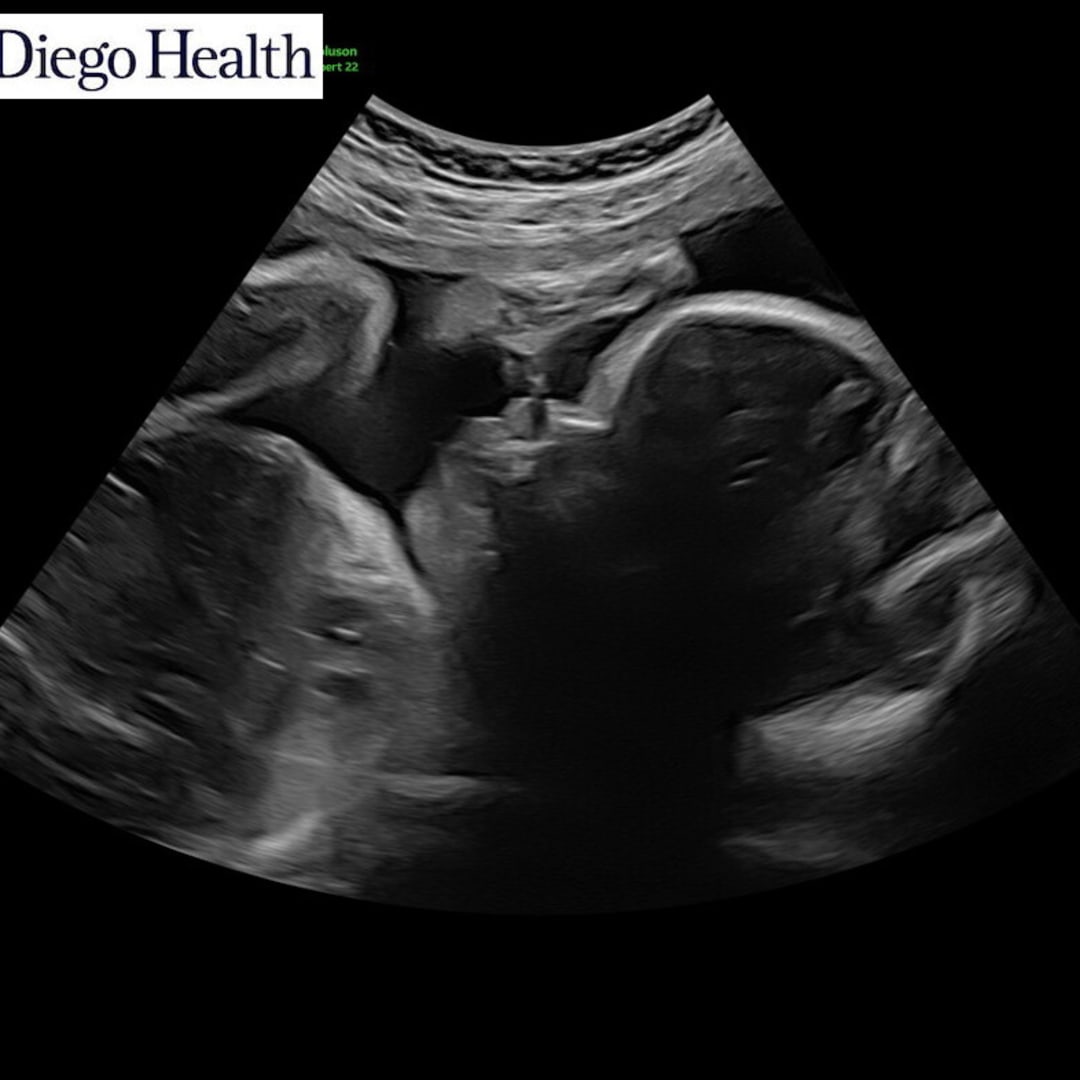 Photo shared by Erica for their Babylist baby registry.