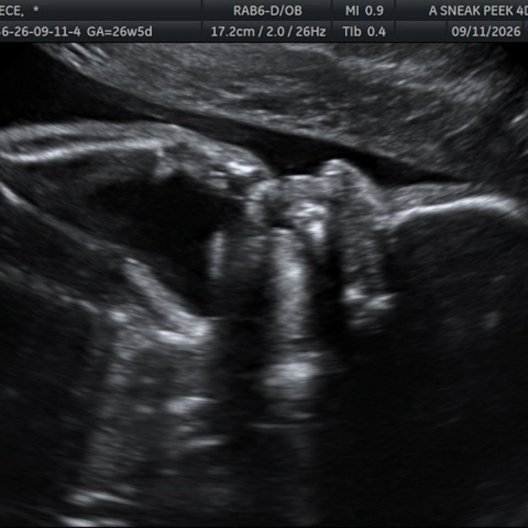 Photo shared by Ariel for their Babylist baby registry.