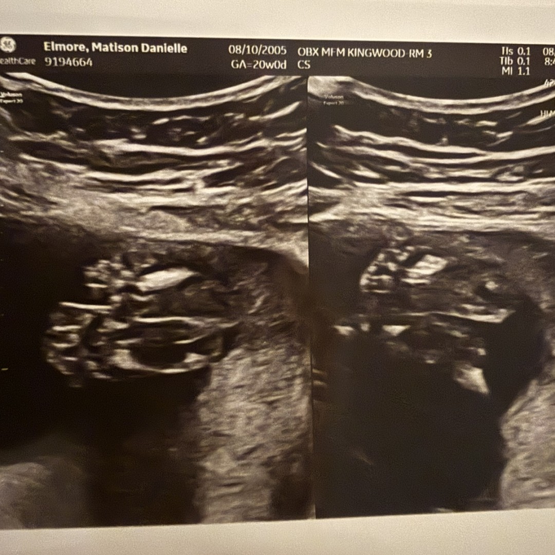 Photo shared by Mattie for their Babylist baby registry.