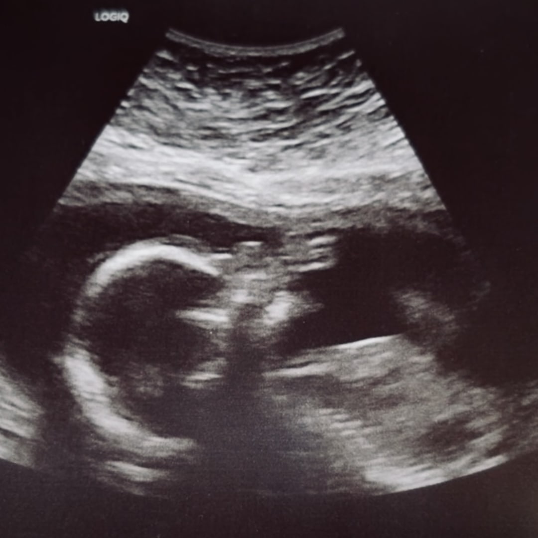 Photo shared by Marjorie for their Babylist baby registry.