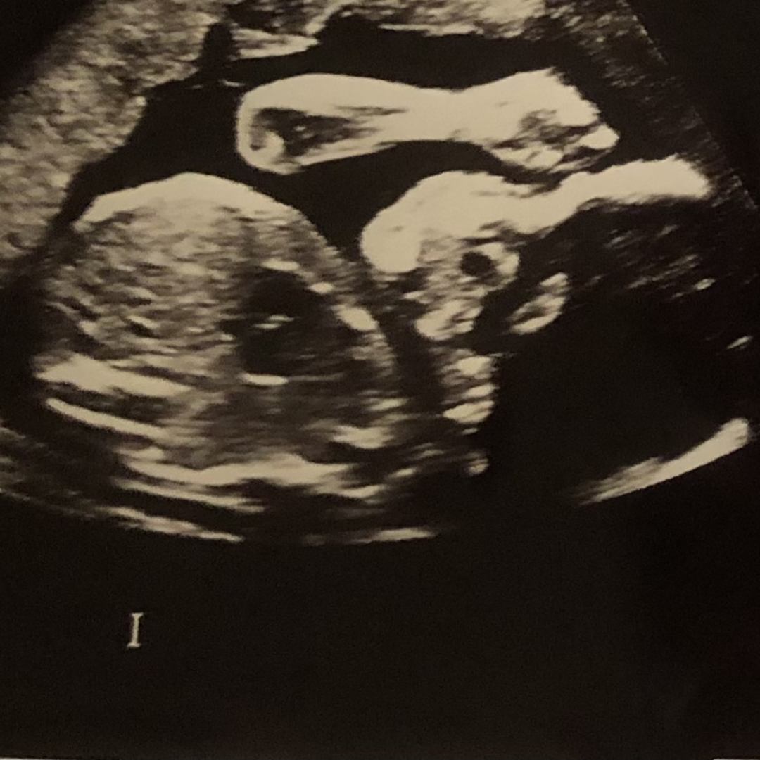 Photo shared by Sophie for their Babylist baby registry.