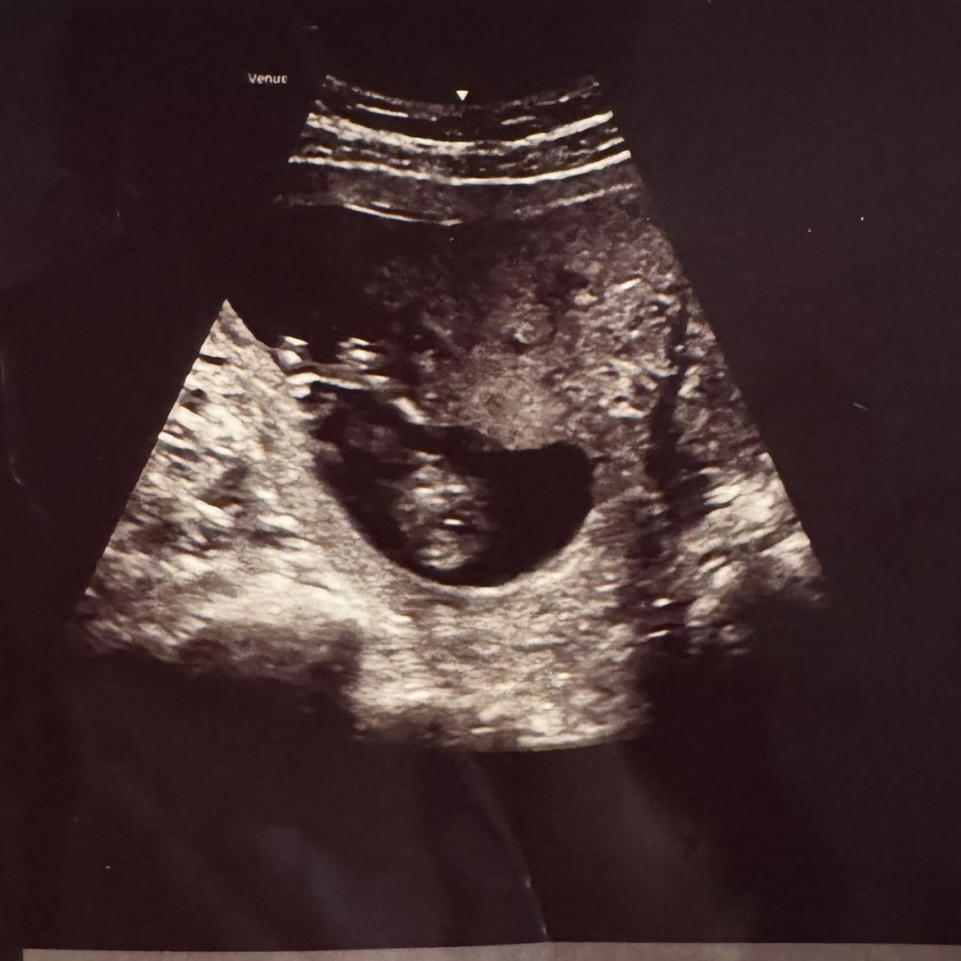 Photo shared by Dejah for their Babylist baby registry.