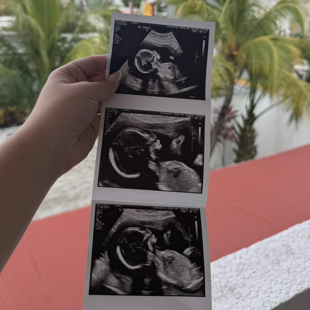Photo shared by Autumn for their Babylist baby registry.