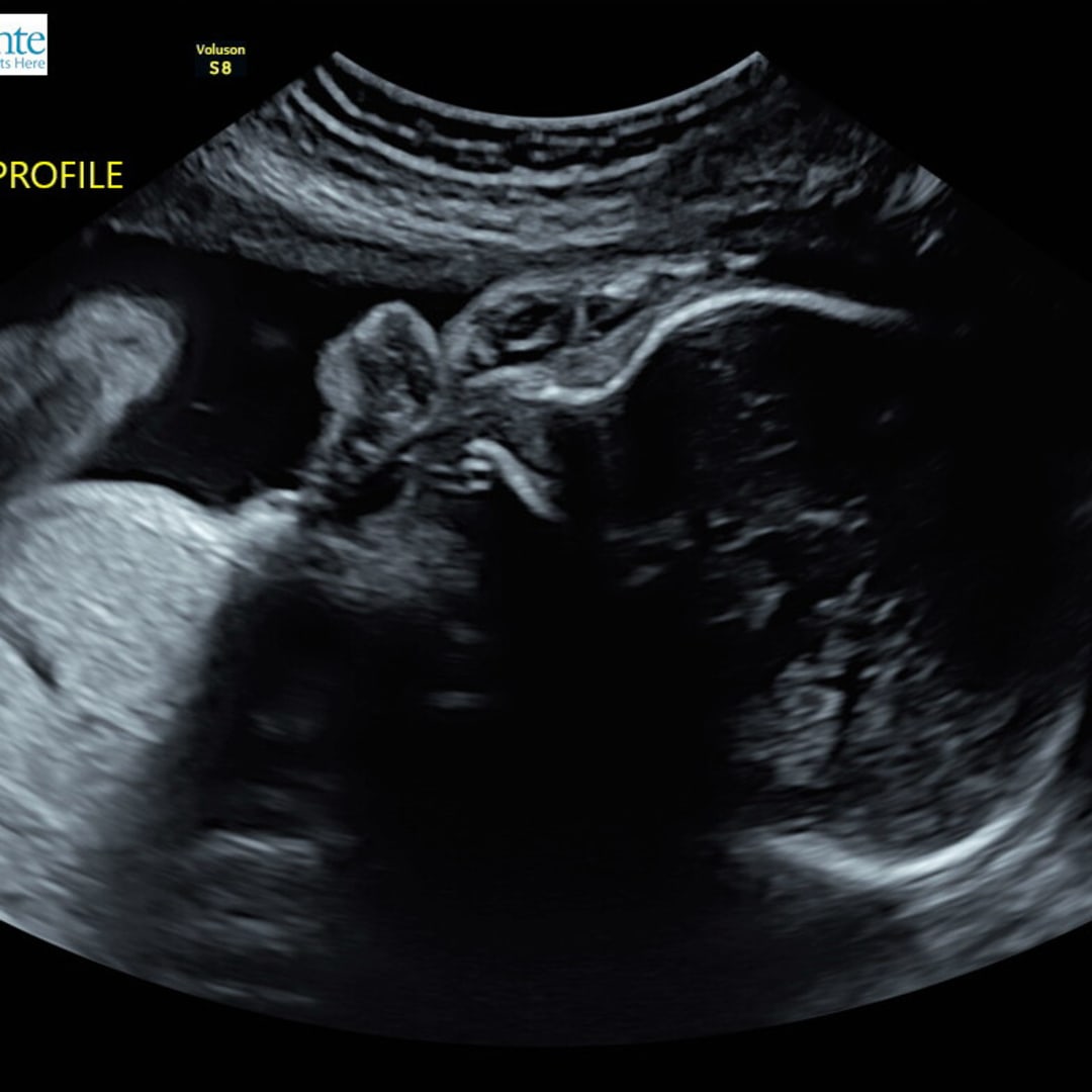 Photo shared by Celeste for their Babylist baby registry.