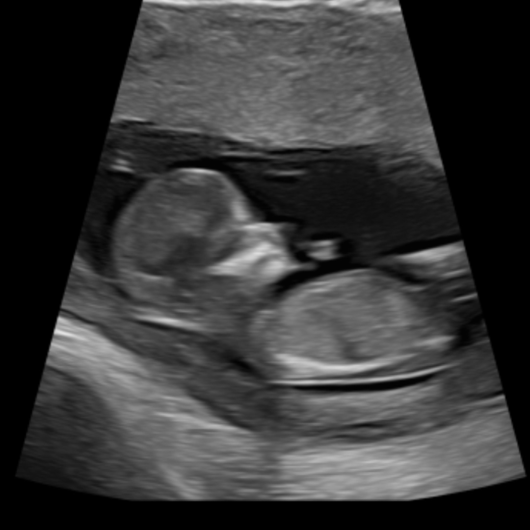 Photo shared by Rachel for their Babylist baby registry.