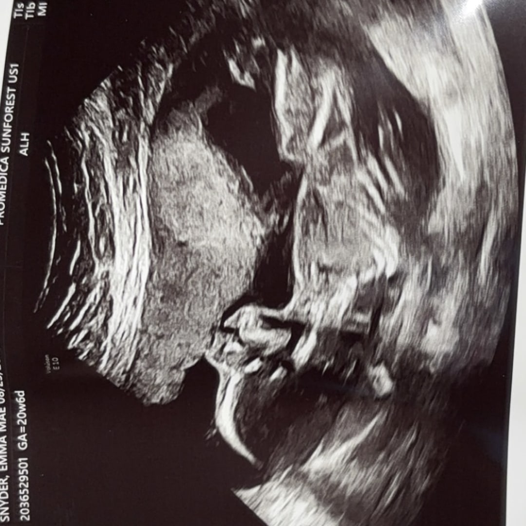 Photo shared by Emma for their Babylist baby registry.
