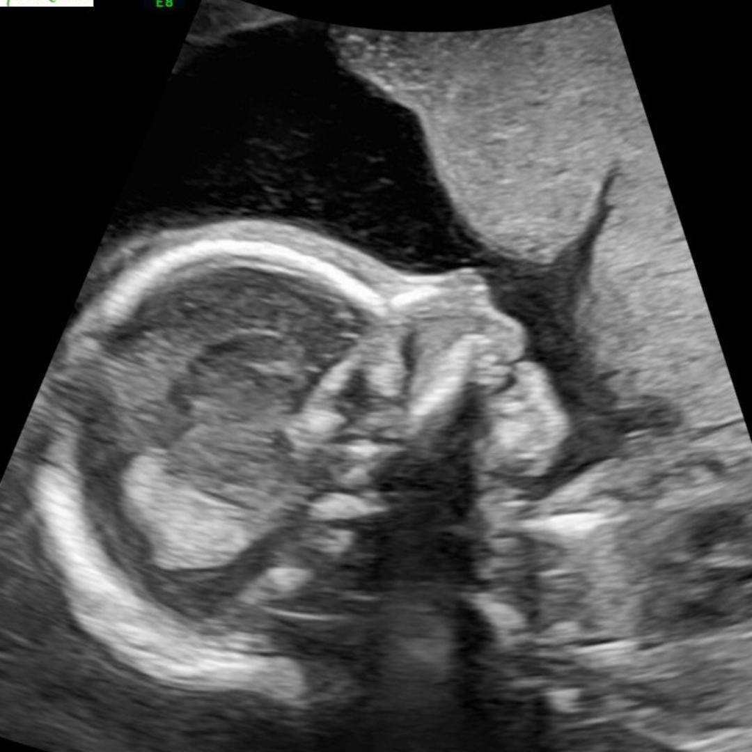 Photo shared by Natasha for their Babylist baby registry.