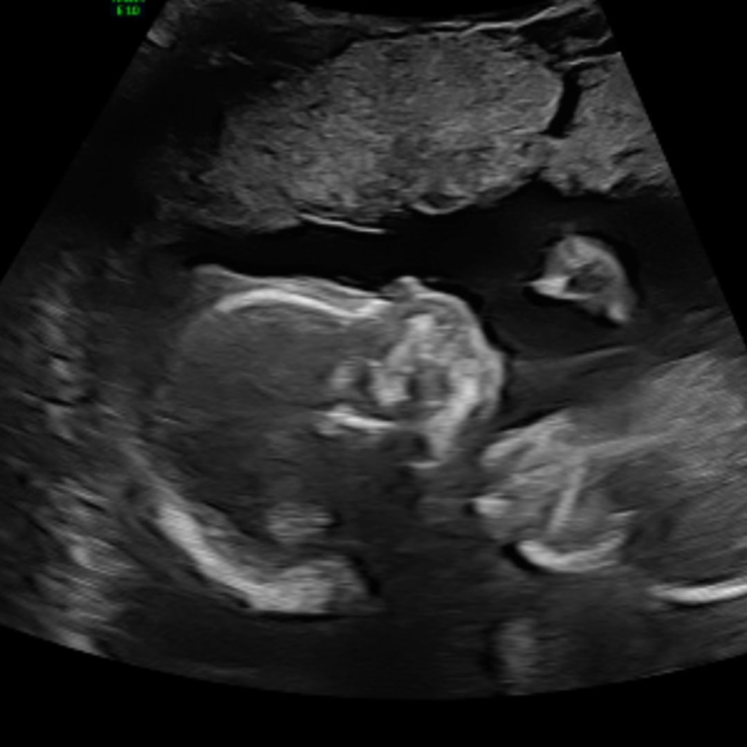 Photo shared by Kylie for their Babylist baby registry.