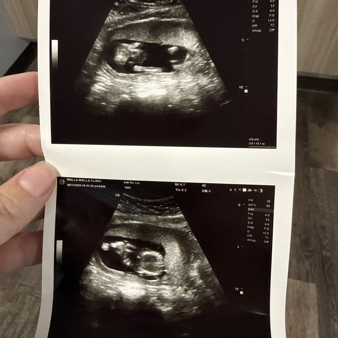 Photo shared by Lilian for their Babylist baby registry.