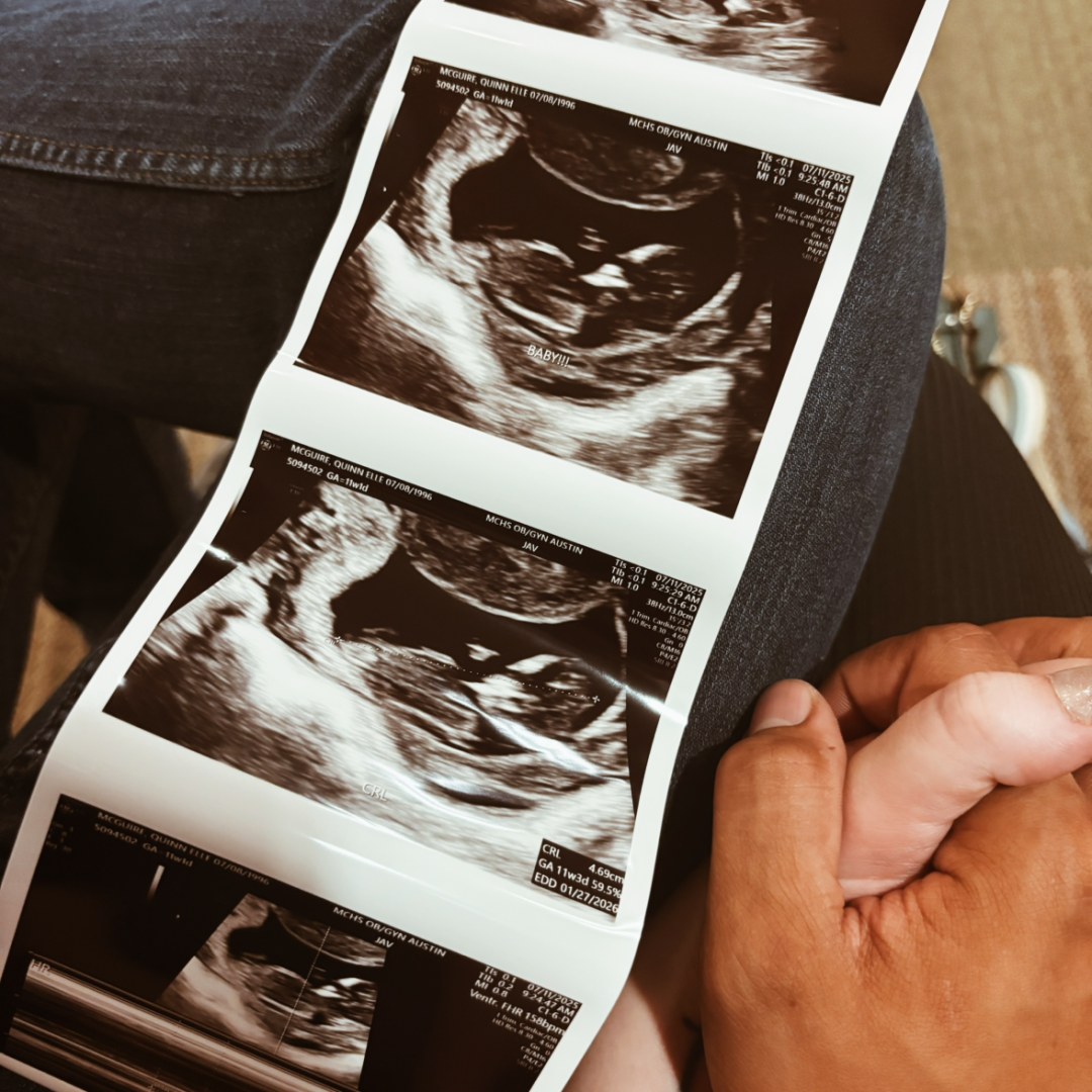 Photo shared by Quinn for their Babylist baby registry.