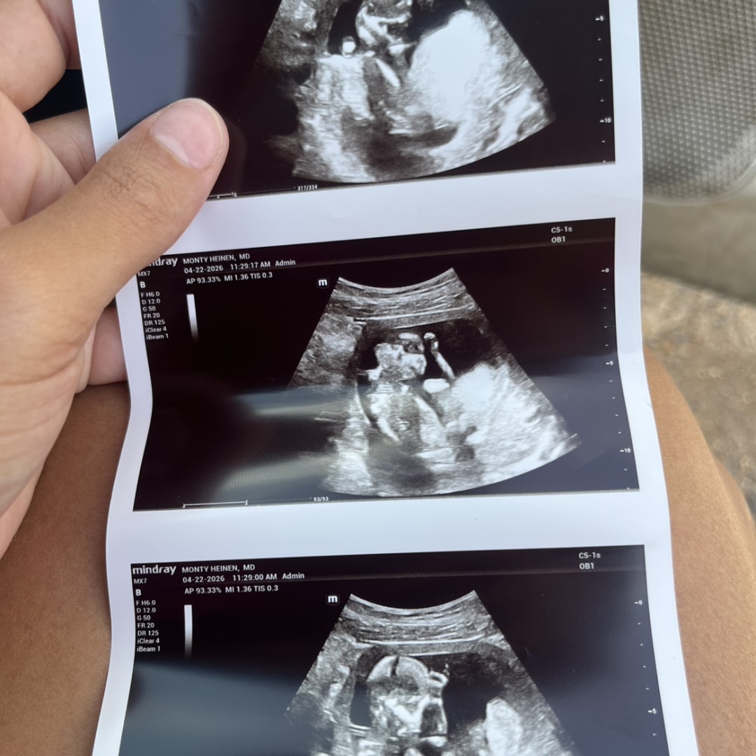 Photo shared by Amya for their Babylist baby registry.