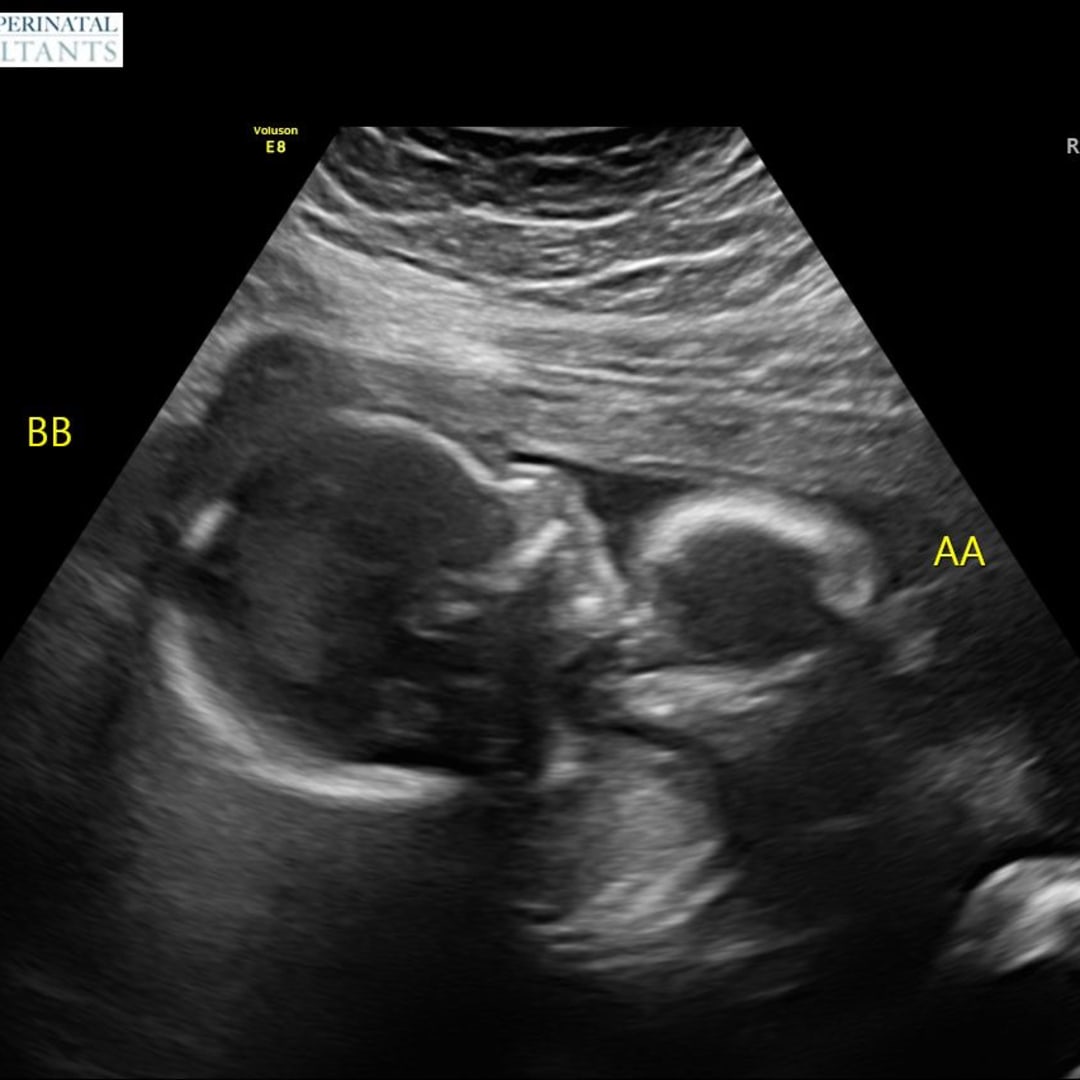 Photo shared by Jordan for their Babylist baby registry.