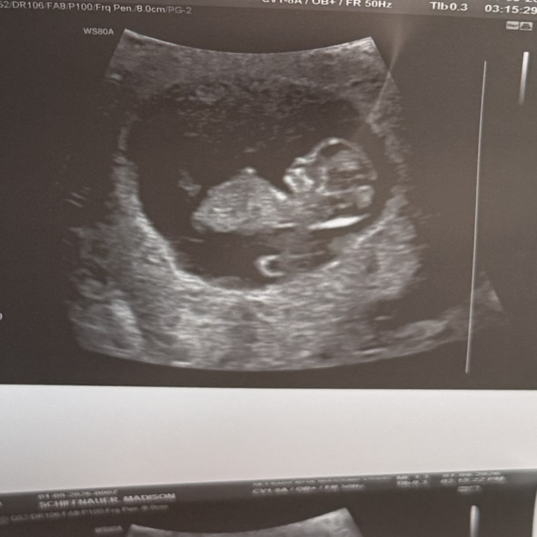 Photo shared by Maddie for their Babylist baby registry.