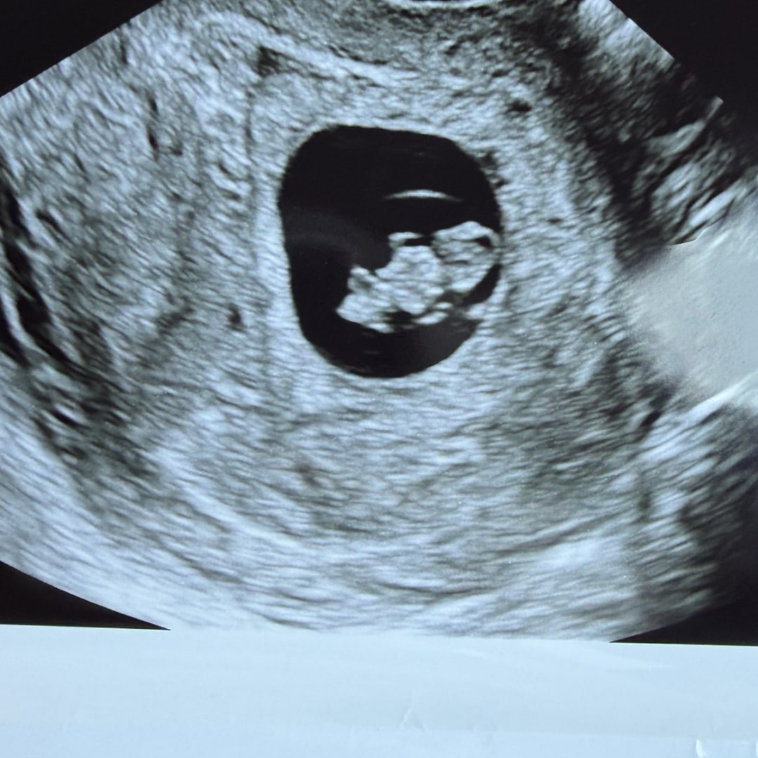 Photo shared by Mallory for their Babylist baby registry.