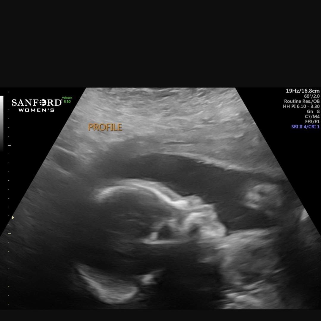 Photo shared by Randee for their Babylist baby registry.