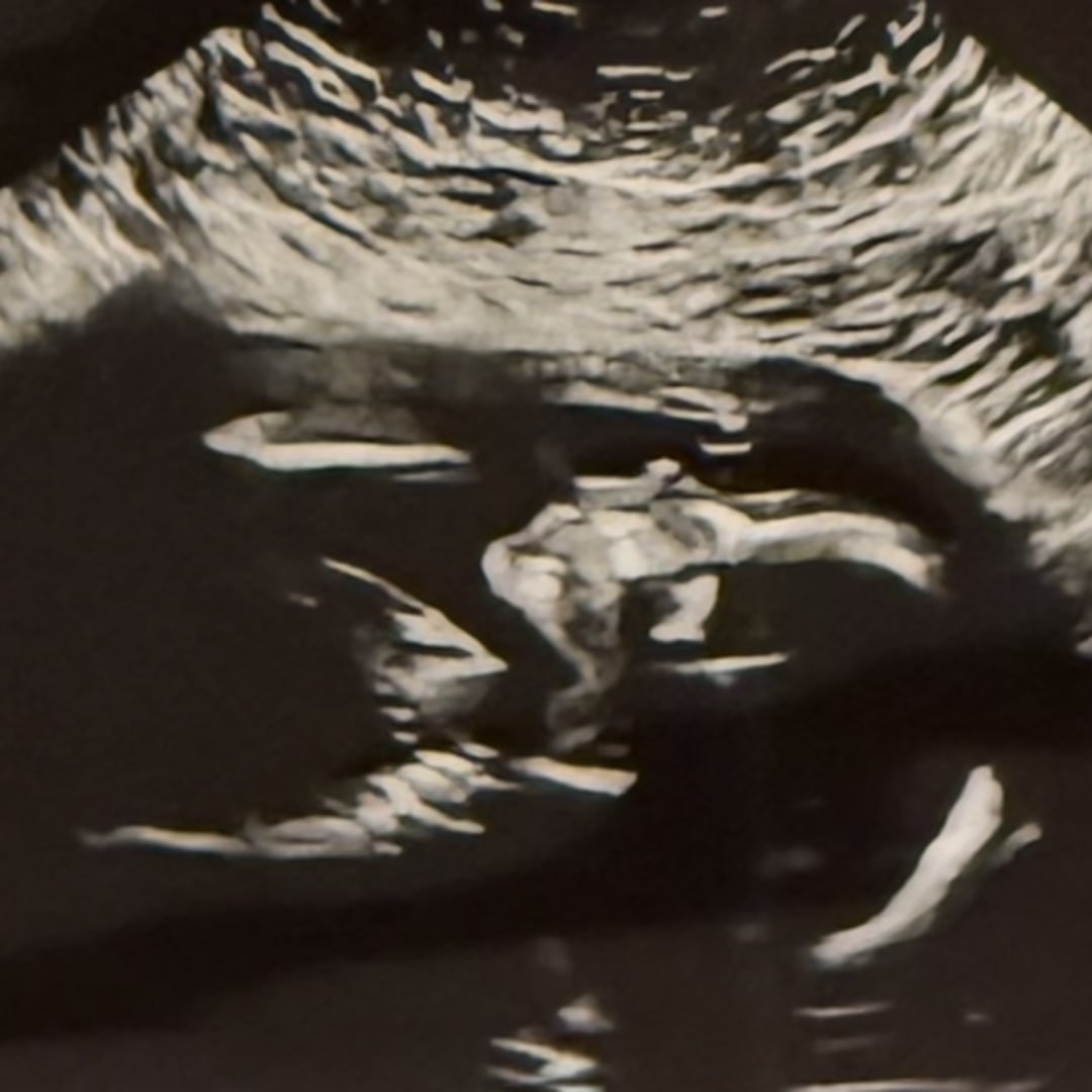 Photo shared by Stephanie for their Babylist baby registry.