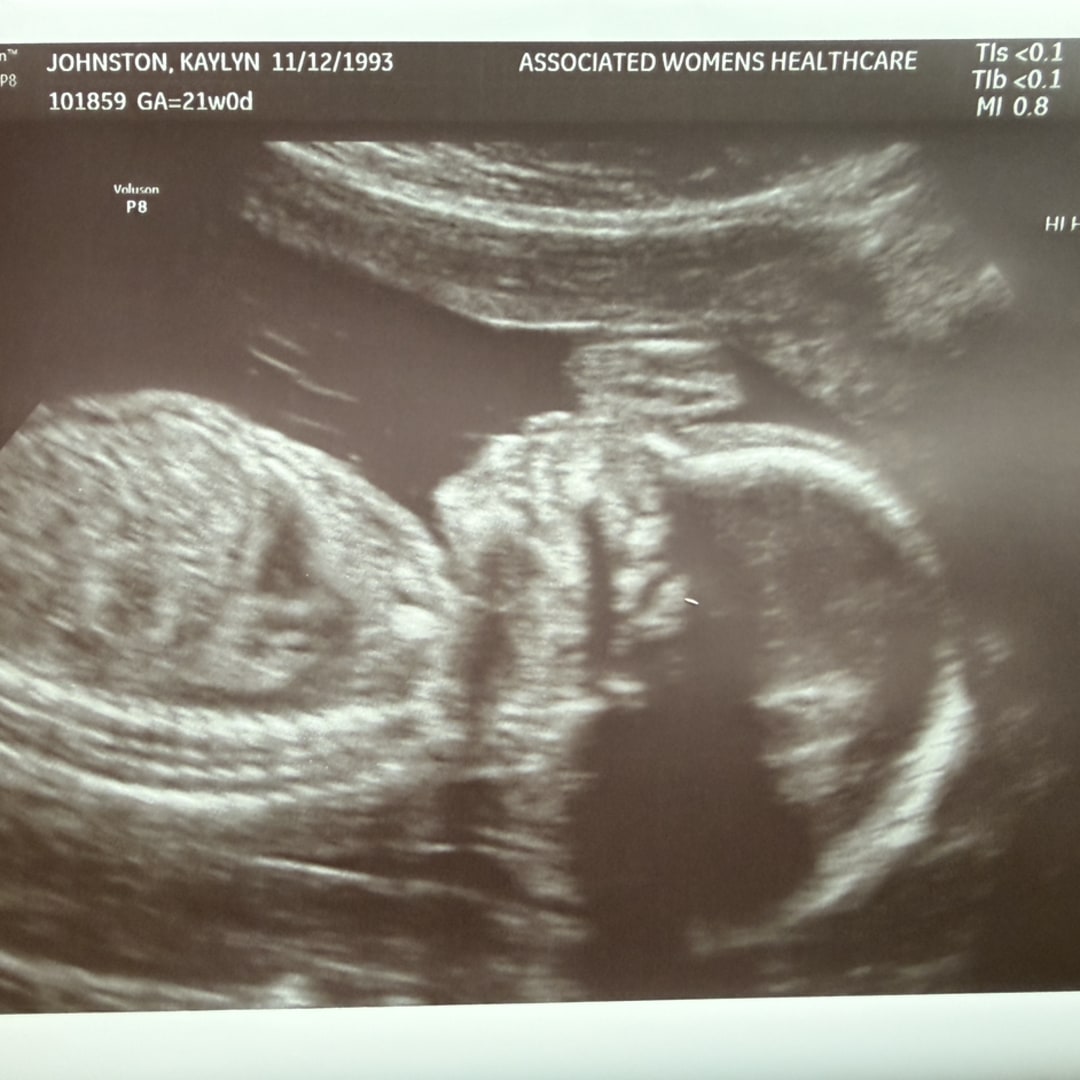 Photo shared by Kaylyn for their Babylist baby registry.