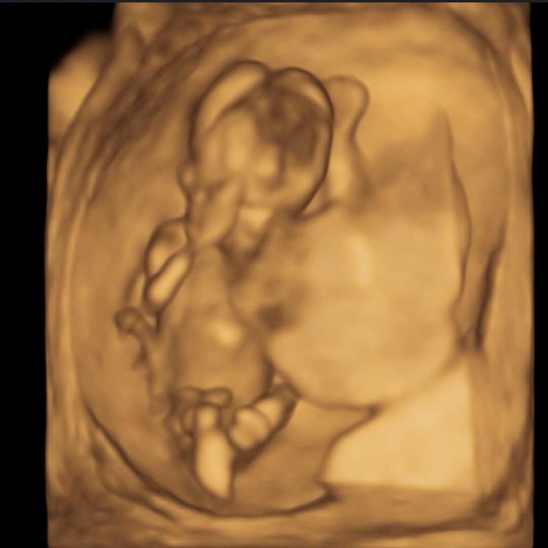 Photo shared by Harley for their Babylist baby registry.