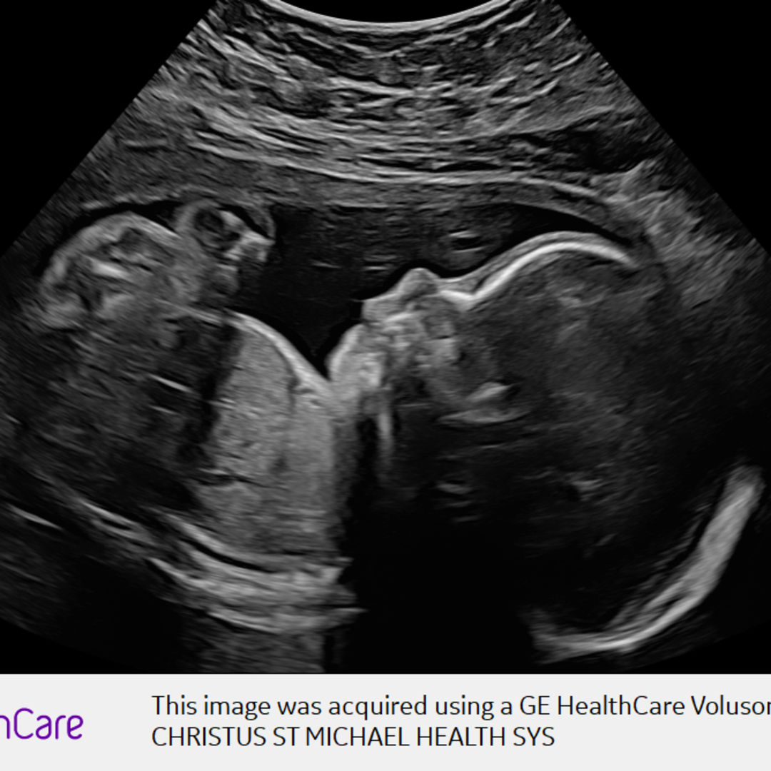 Photo shared by Lizzy for their Babylist baby registry.